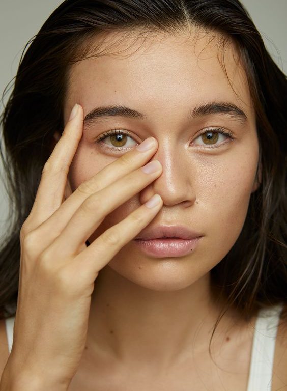 What You Need to Know About Acne: 5 Ways to Achieve Healthy Skin